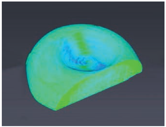 Effondrement d’une goutte de suspension liquide (Ø = 1,48 mm) au cours de son séchage : visualisation de l’accumulation de solide (vert foncé) en périphérie.